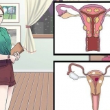 Behandling af vaginale cyster