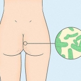 Slip af med acne på dine balder