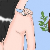 Slip af med acne på din krop