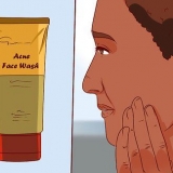 Slip af med en bums med aloe vera gel