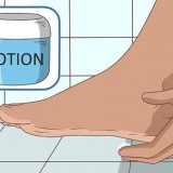 Slip af med kløende fødder