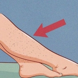 Slip af med uønsket hår