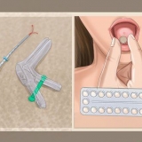 Ved hvorfor du ikke får din menstruation længere