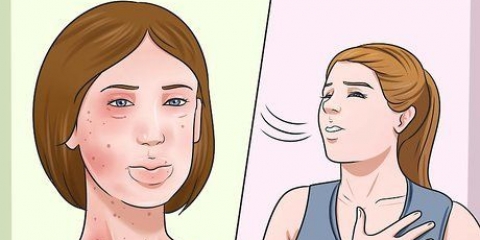 Behandling af allergier