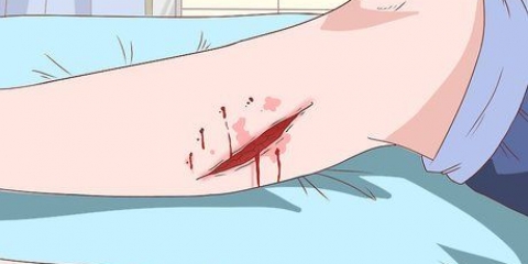 Behandling af cellulite
