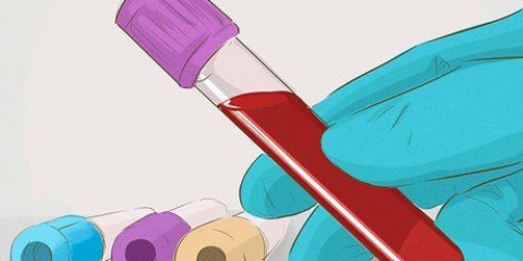 Stigende glomerulær filtrationshastighed