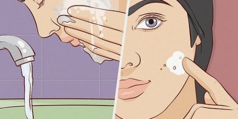 Pleje af huden efter mikrodermabrasion