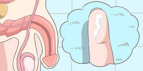 Genkendelse af symptomerne på klamydia (for mænd)