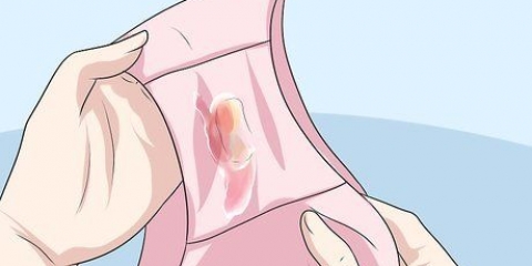 Genkendelse af symptomerne på klamydia (for kvinder)