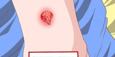 Genkendelse af symptomerne på en mrsa-infektion