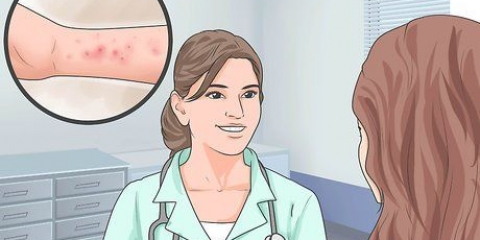 Lindring af symptomerne på spongiotisk dermatitis