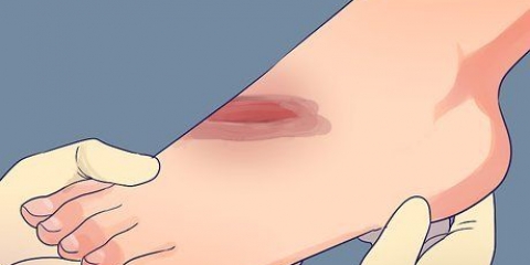 Behandling af dybe snit