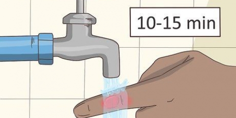 Behandling af en vabel på din finger