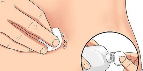 Behandling af en irriteret navlepiercing