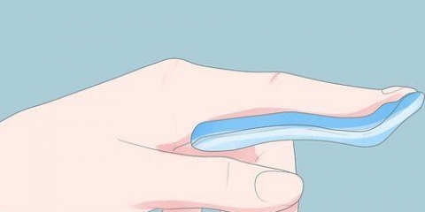 Behandling af en stammende finger