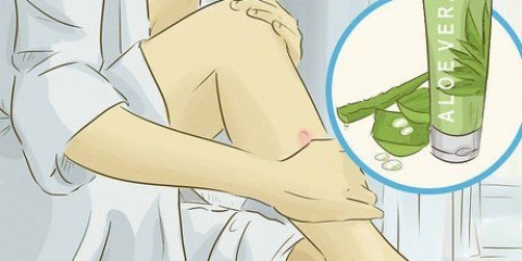 Behandling af en keloid