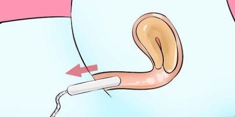Fjern en tampon