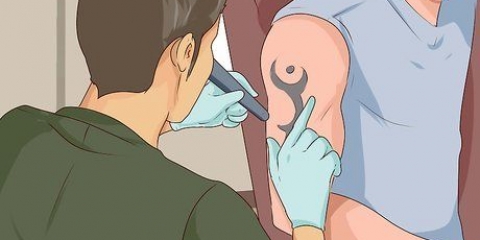 Fjern en tatovering