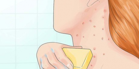 Behandling af folliculitis