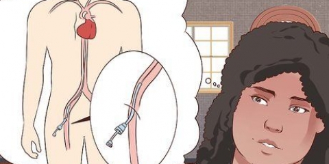 Kom sig efter en angiografi