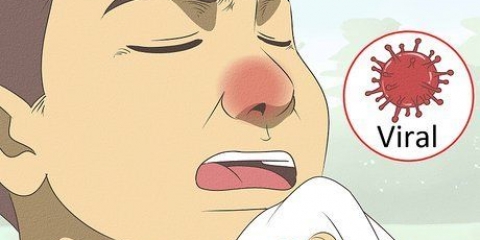 Anerkendelse af forskellen mellem bakteriel og viral tonsillitis