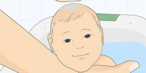 Behandling af varmeudslæt hos babyer