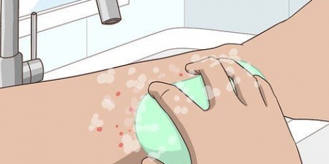 Behandling af midgebid