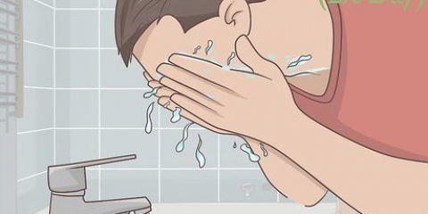 Slip af med acne på den naturlige måde