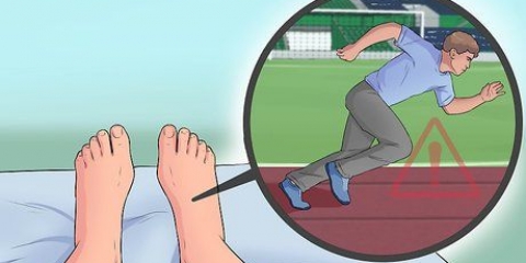 Behandling af plantar fasciitis