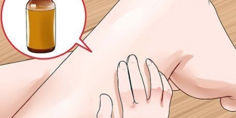 Behandling af ringorm: kan det naturligt?