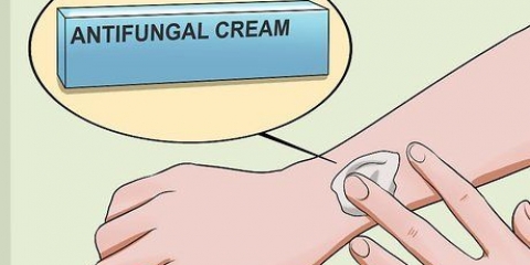 Behandl ringorm