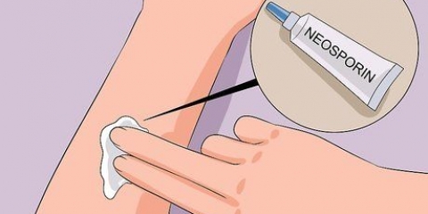 Stop med at klø sårskorper