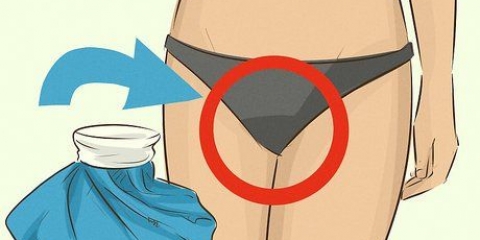 Lindre vaginale smerter