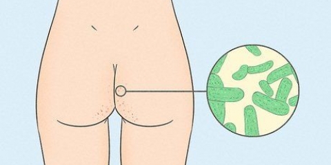 Slip af med acne på dine balder