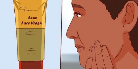 Slip af med en bums med aloe vera gel