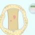 Genkendelse af unormal blødning mellem menstruation