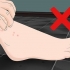 Behandling af sandloppebid
