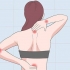 Behandling af en klemt nerve