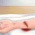 Behandling af dyb slid
