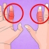 Behandling af en brækket finger