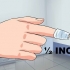 Behandling af en indgroet negl