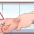 Behandling af et gigtangreb