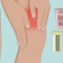 Behandling af senebetændelse i quadriceps