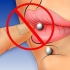 Rengøring af en piercing