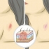 Giv en hickey