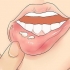 Genkender herpes