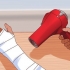 Du kradser, når du klør under dit gips