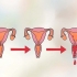 Bestem din mest frugtbare dag for at blive gravid