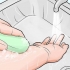 Behandling af myggestik