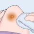 Behandl bylder